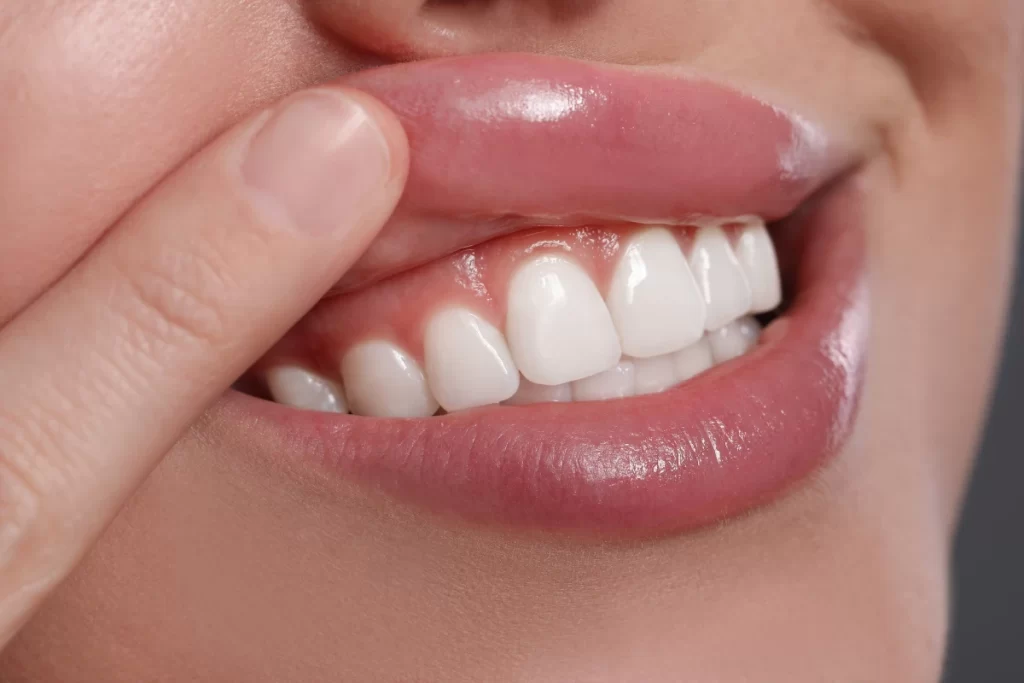 لثه حساس | حساسیت لثه