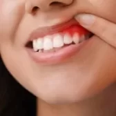 لثه حساس